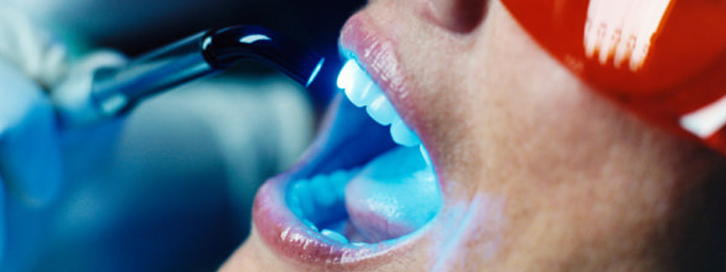 clareamento-dental-laser-fiama-pereira